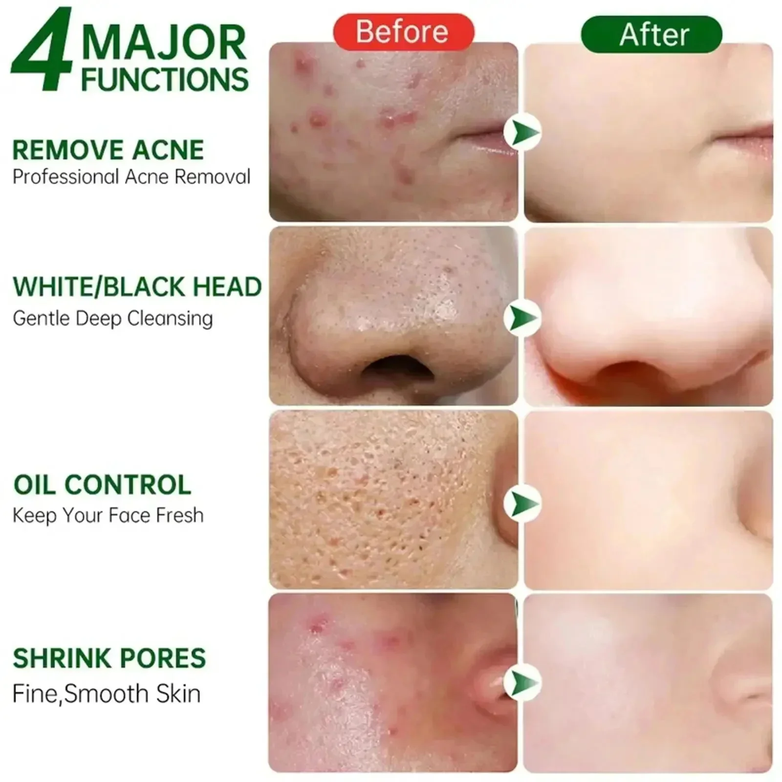 살리실산 모공 클리어링 크림 모공 축소 블랙헤드 제거  - Collagen Peptide Powder 리뷰 및 가격